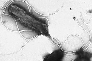 Electron micrograph of H. pylori possessing mu...
