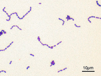 microscopic image of Streptococcus mutans ATCC... microscopic image of Streptococcus mutans ATCC...