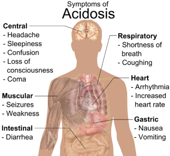 English: General symptoms of acidosis. (See al...
